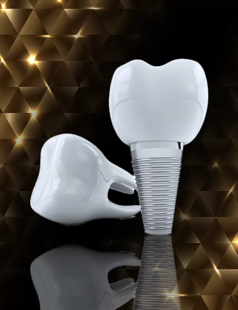 https://parlaclinic.com/wp-content/uploads/2023/11/implant-1.png