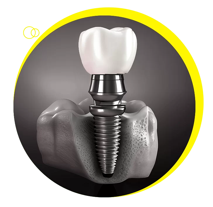 https://parlaclinic.com/wp-content/uploads/2023/11/oval_2-2.png