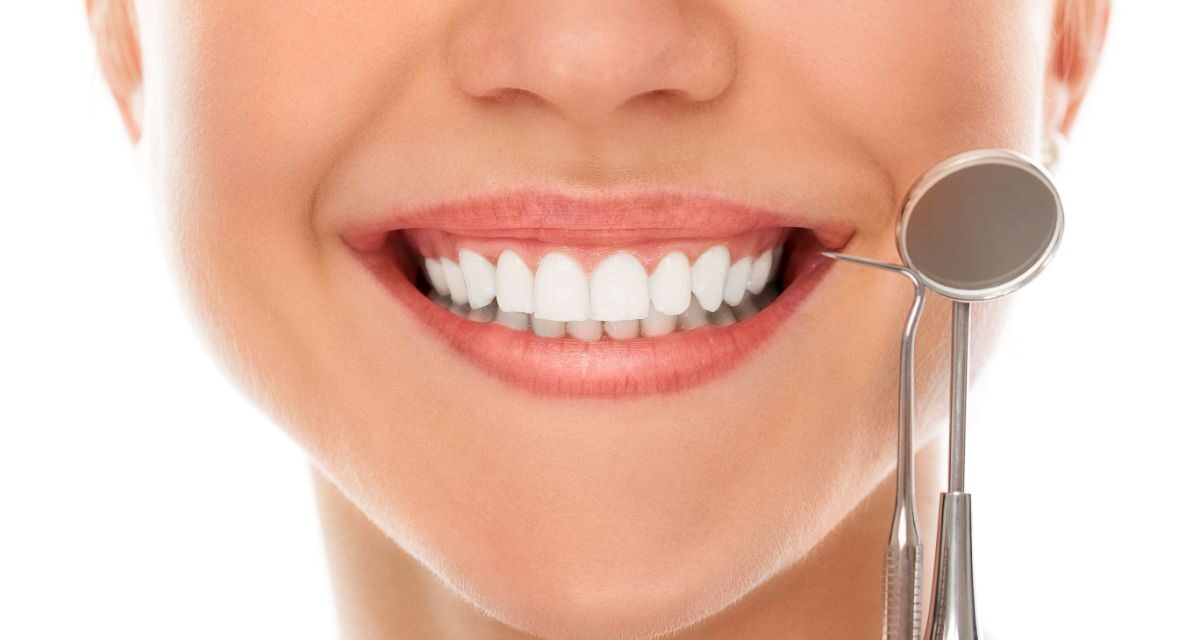 Hollywood Smile: Is it worth it? All you need to know