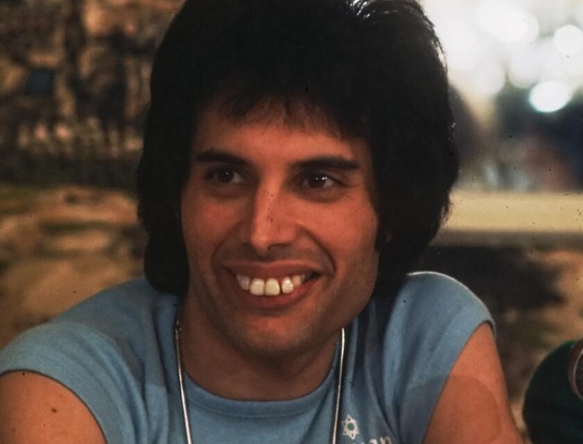 Freddie Mercury Teeth & Why He Never Fixed Them