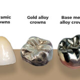 types-of-dental-crowns-imade-jpg