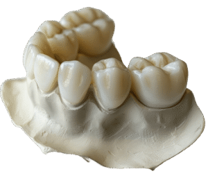 dental-crowns-illustration-pic.jpg