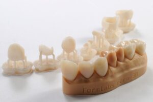 resin-tooth-caps-image.jpg