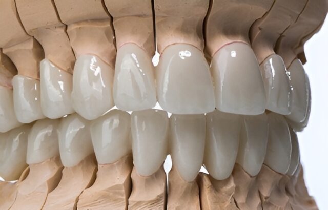 zirconium-dental-crown-image.jpg