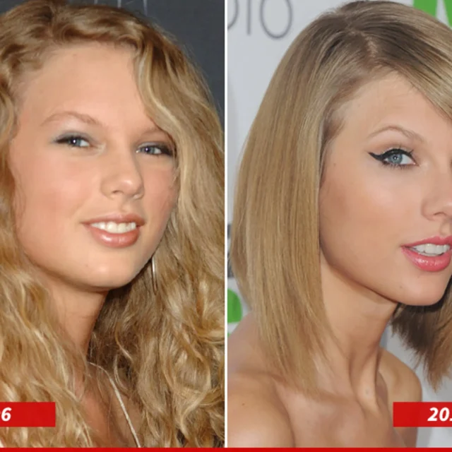 taylor-swift-teeth-before-after.jpg