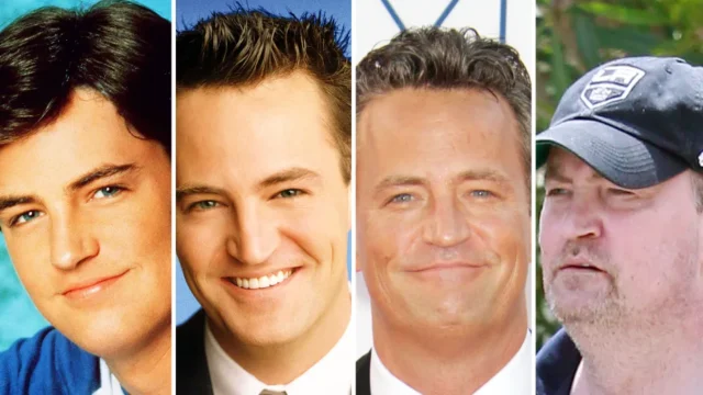 matthew-perry-teeth-transformation-before-and-after.jpg