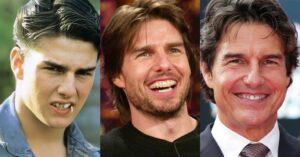 tom-cruise-smiling-showing-his-teeth-without-veneers-and-with-veneers