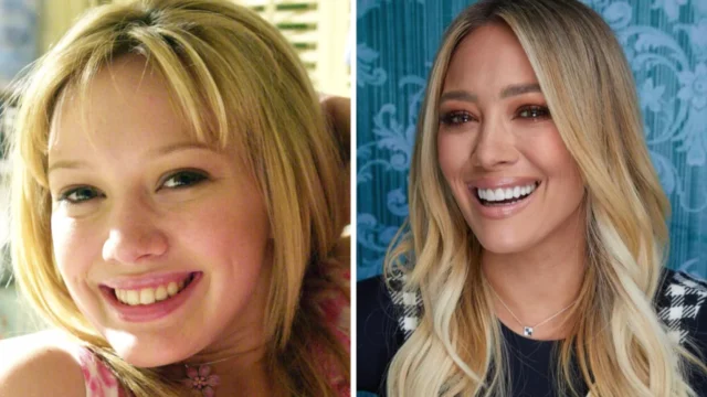 celebrities-with-veneers-before-and-after-hillary-duff.jpg