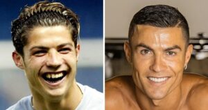 christiano-ronaldo-teeth-with-veneers-and-without-veneers.jpg
