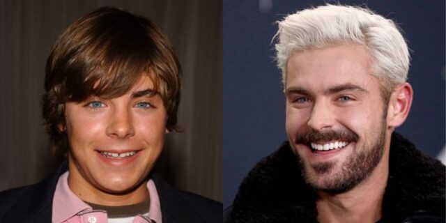 celebrities-with-veneers-zac-efron-smiling.jpg