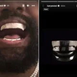 kanye-west-teeth-grills.jpg