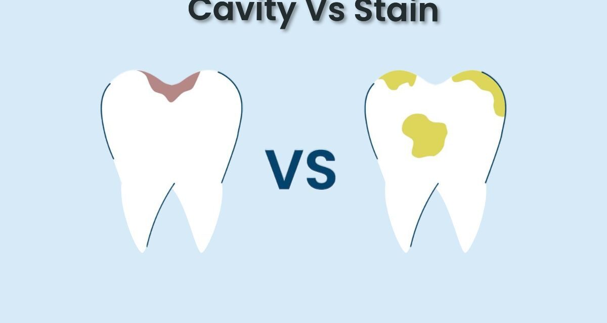 Cavity vs Stain: How to Identify and Treat Both