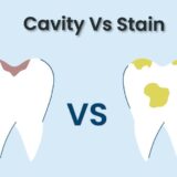 cavity-vs-stain-how-to-tell-the-difference.jpg