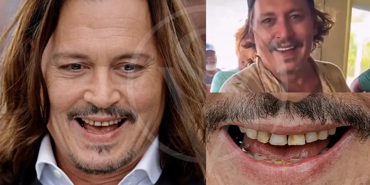 Johnny Depp Teeth: What’s The Trend About