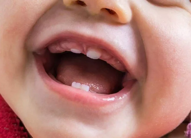 how-many-teeth-humans-have-baby-teeth.jpg