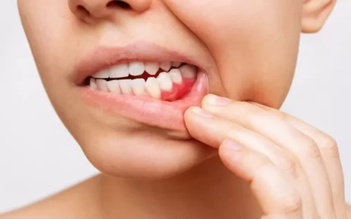 woman-suffering-from-gum-pain-that-needs-relief.jpg
