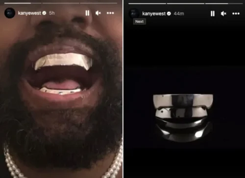 kanye-west-teeth-grills.jpg