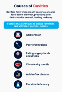 Cavity-vs-Stain-causes-of-tooth-cavity.jpg