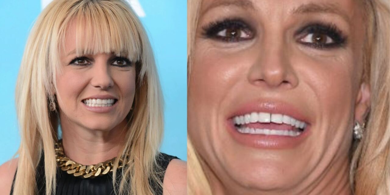 Britney Spears Teeth Through The Years Explained