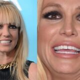britney-spear-teeth-side-by-side-comparison
