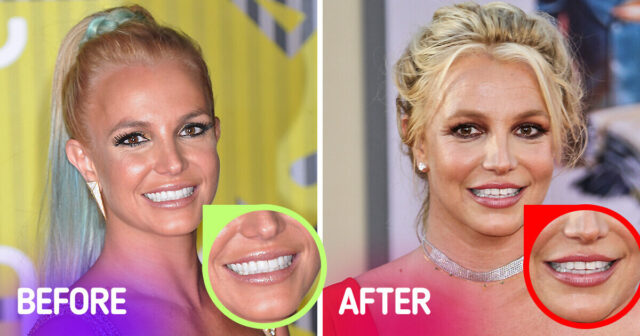 britney-spears-smiling-before-after